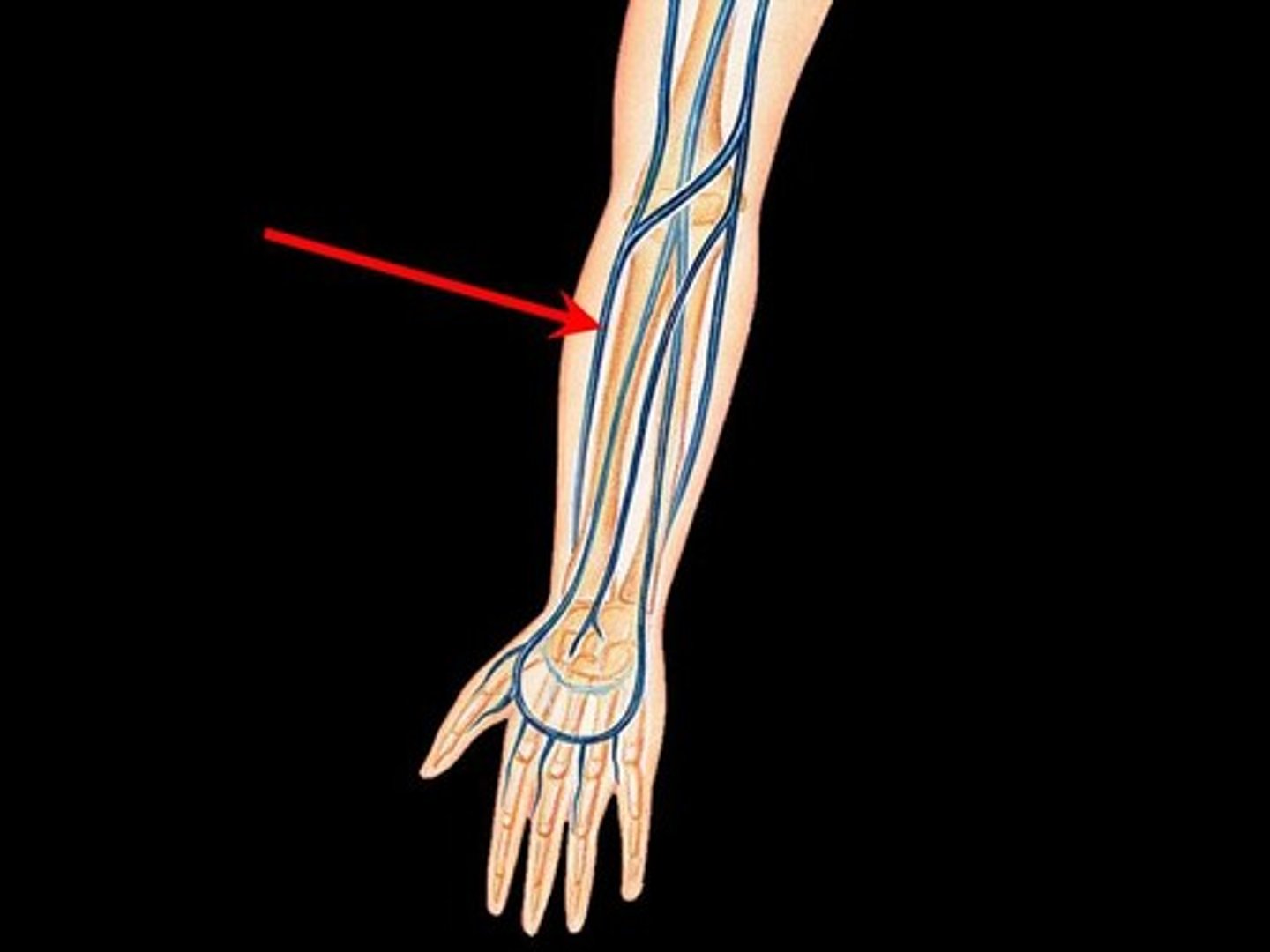 <p>Cephalic vein of the forearm</p><p>A large vein that is easily accessed (Go at least 8-10 cm above the thumb to avoid the radial nerve)</p>