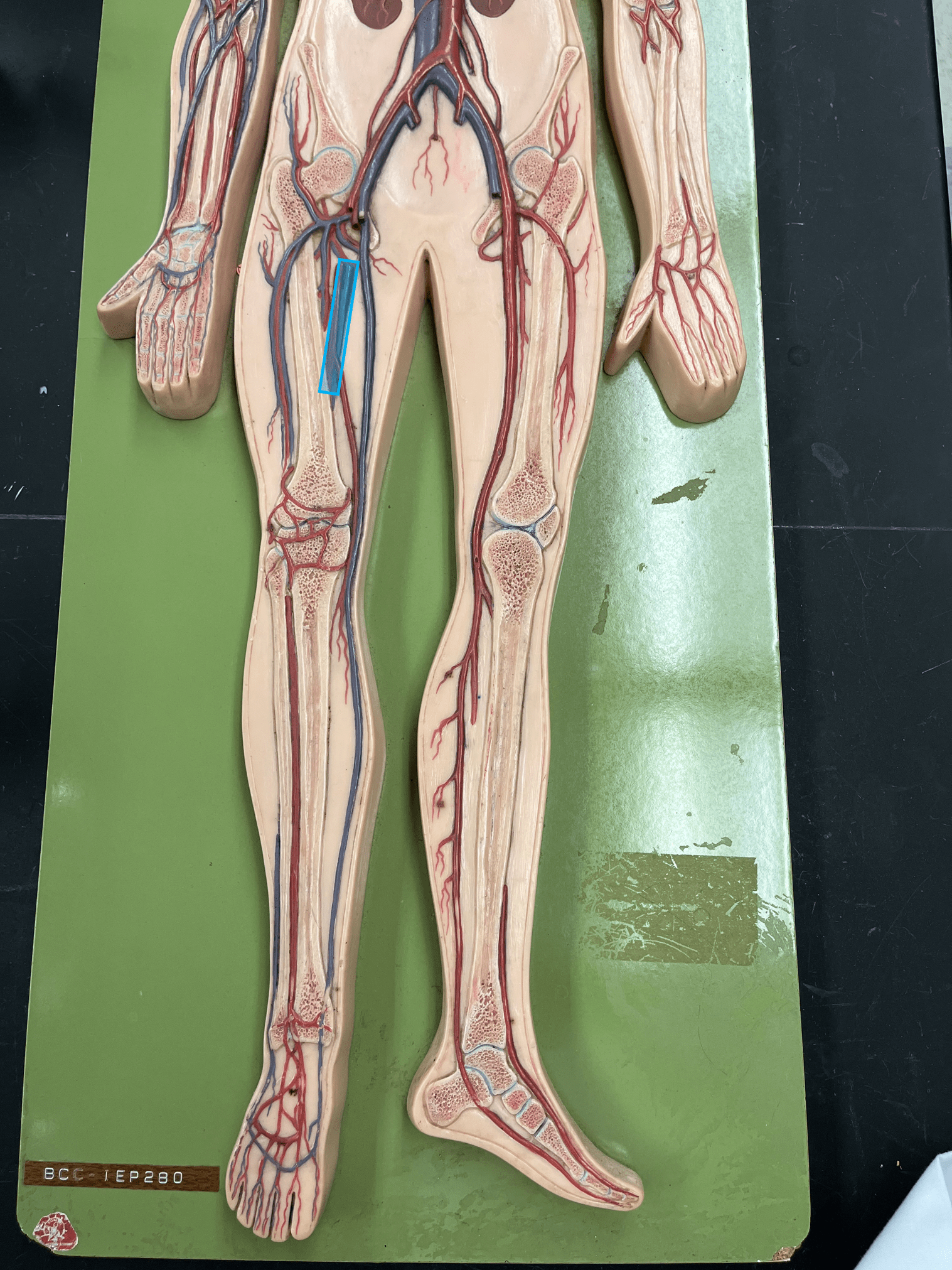 <p>• A vein of the lower limb.</p>
<p>• Drains the deep thigh muscles.</p>
<p>• Empties into the external ilaic vein.</p>