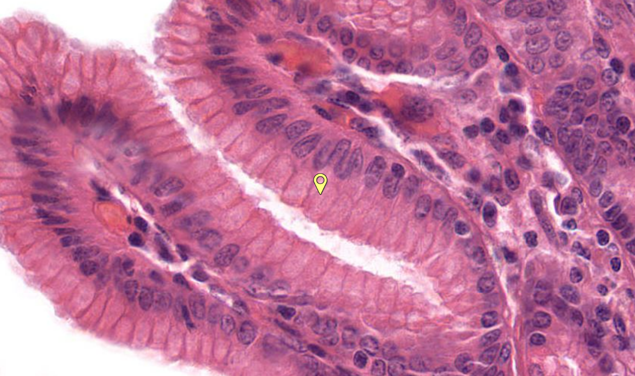 <p>cell type, stomach</p>