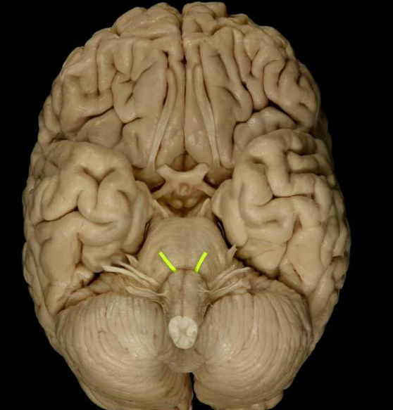<p>List the nerve name, roman numeral, and function.</p>