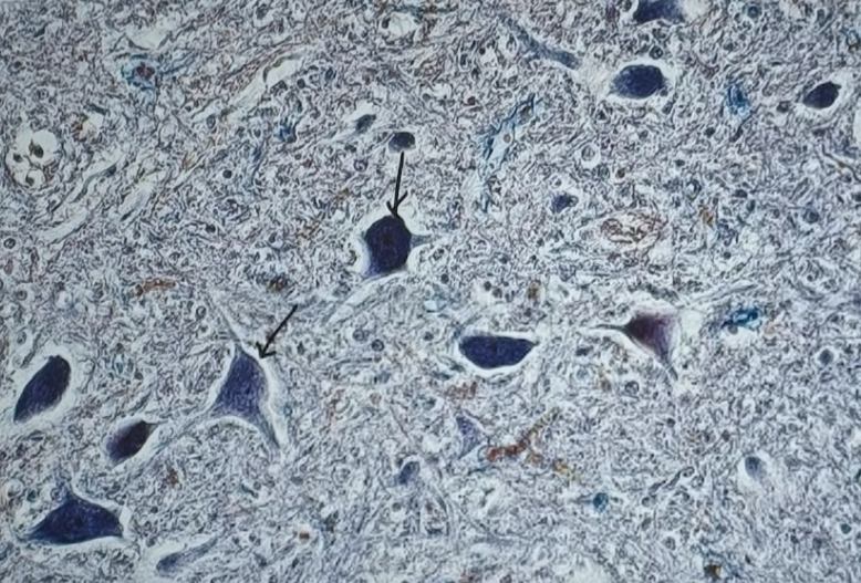<p>Identify the cells at the tip of the arrow</p>