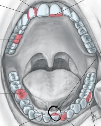 <p>Surface closest to the tongue</p>