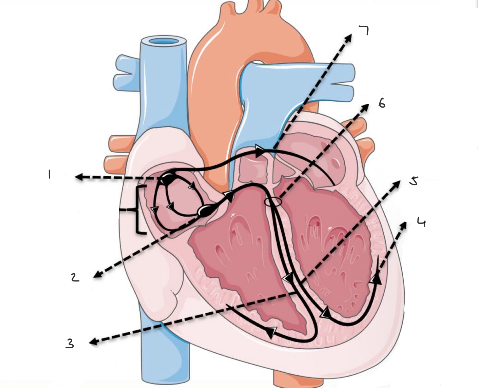 term image