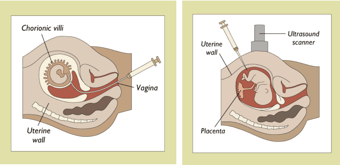 <p>ultrasound, sonograms, CVS (Chorionic villi sampling), amniocentesis</p>