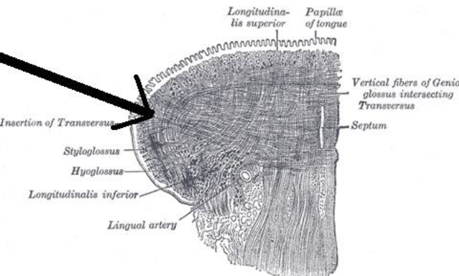 <p>narrowing of the tongue</p>
