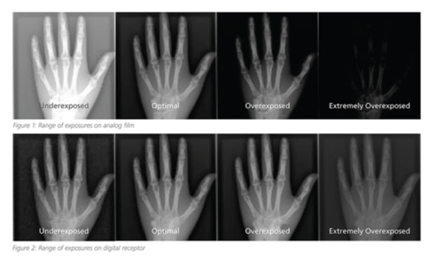 <p>Representation of the patients anatomy on image</p>