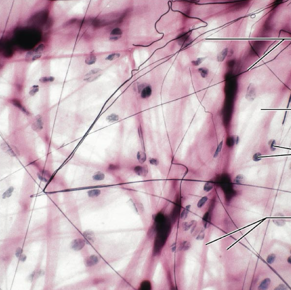 <ol><li><p><strong>Name the tissue type</strong></p></li><li><p><strong>Name the cell type</strong></p></li><li><p><strong>Know where it is found in the body</strong></p></li><li><p><strong>Know its structure </strong></p></li><li><p><strong>What is the white background?</strong></p></li></ol><p></p>