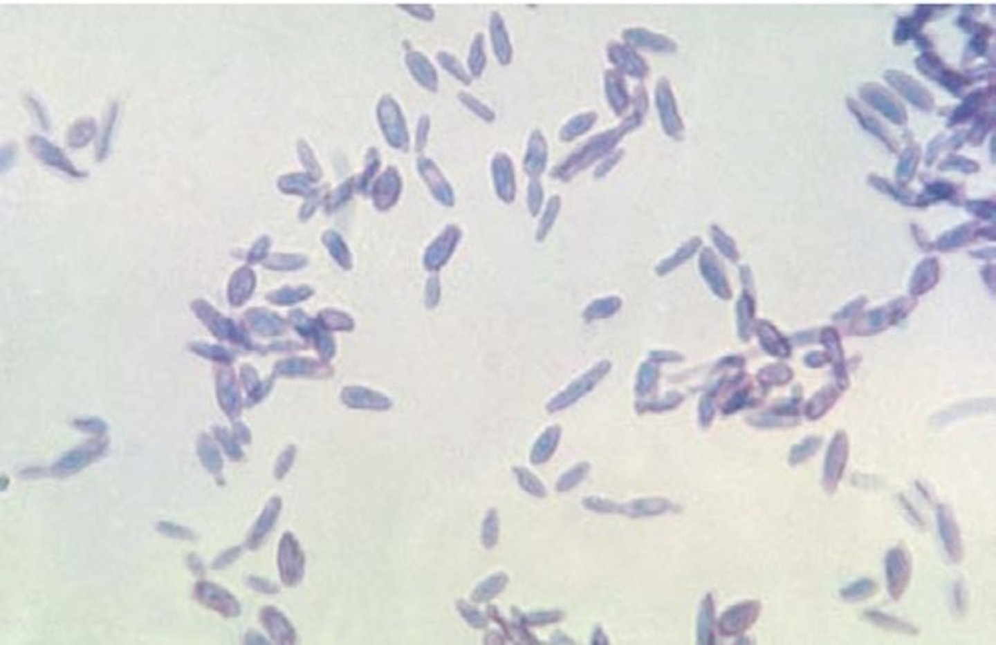 <p>b. Sporotrichosis</p>