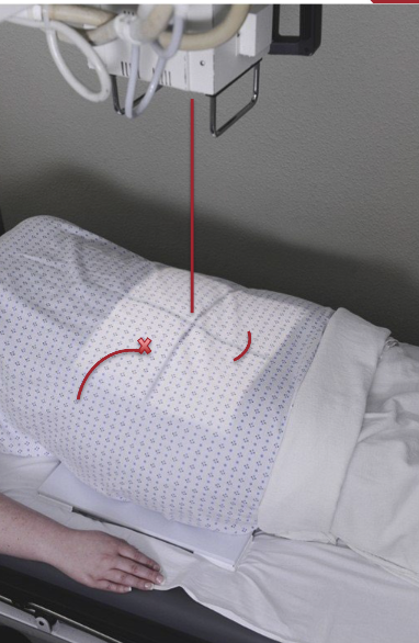 <ul><li><p>Cr perpendicular to IR, centered midway between level of ASIS and the symphysis pubis (this will be approximately 2 inches inferior to level of ASIS)</p></li><li><p>Top of light field 1 inch above iliac crests</p></li></ul><p></p>