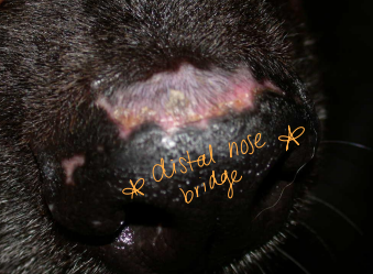 <p>Discoid Lupus Erythematosus (DLE)</p>