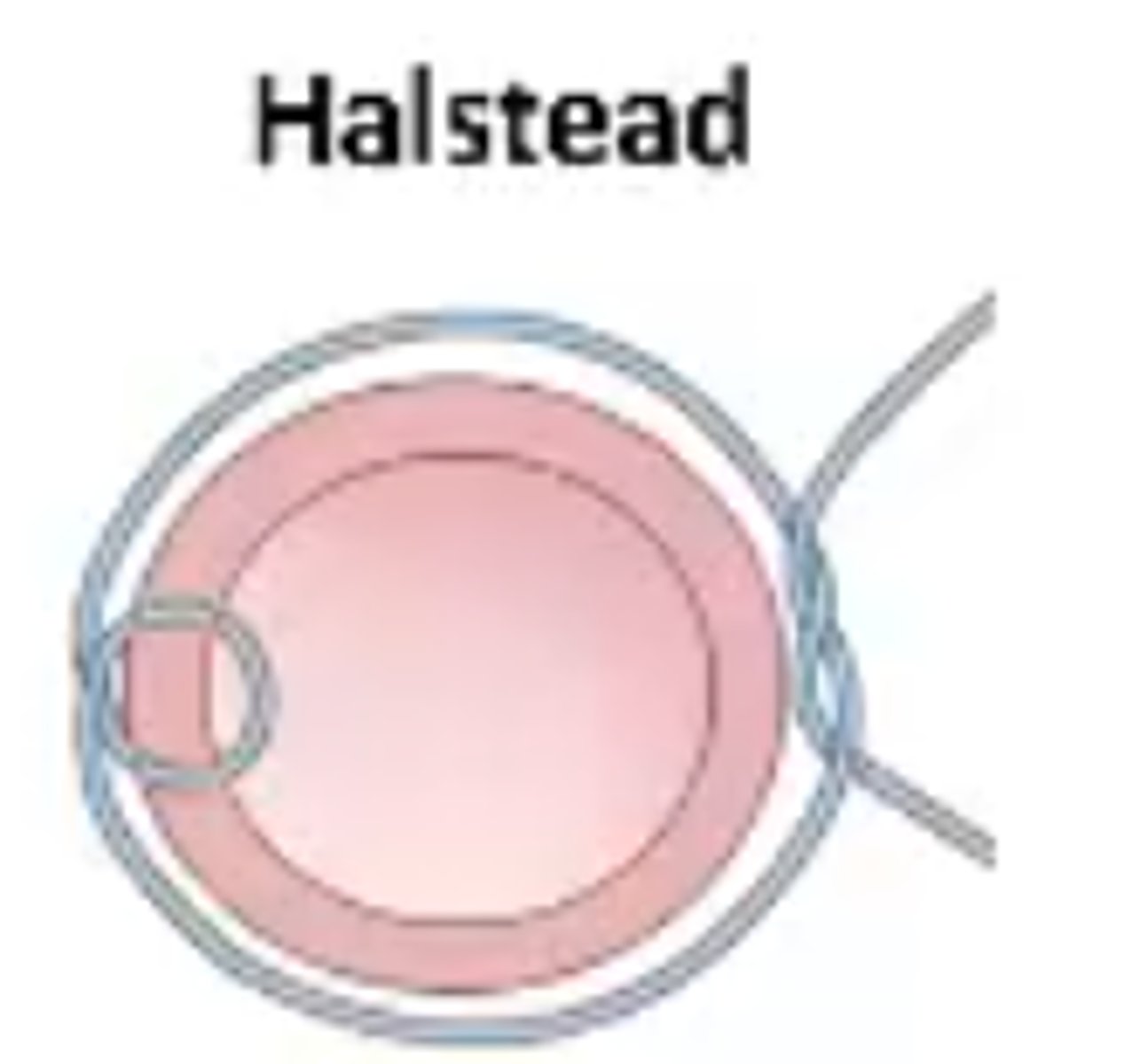 <p>Halstead</p>