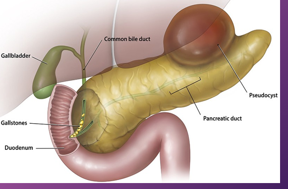 <p>A ______ is a result from _____ to the gland or _______</p>