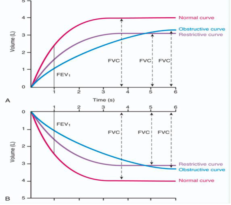 <p>When given a flow volume loop determine what the shape of the loop indicates - restrictive disease </p>
