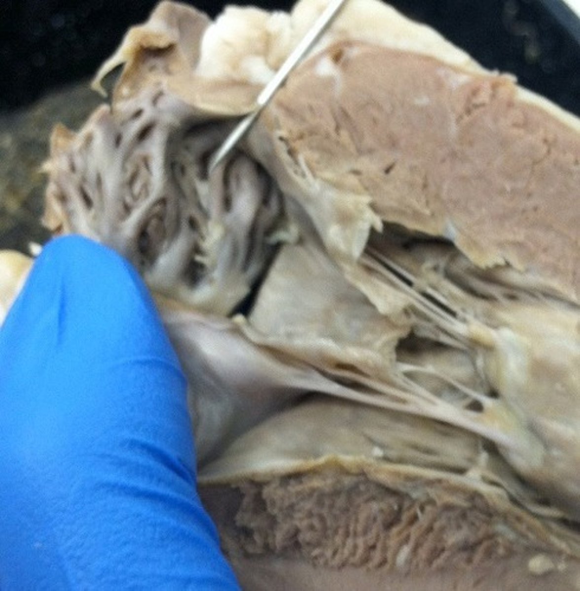 <p>internal ridges of myocardium in right atrium and both auricles</p>