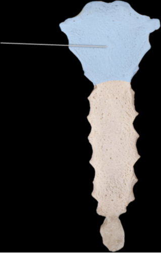 Which of the following muscles do NOT originate on the highlighted structure?