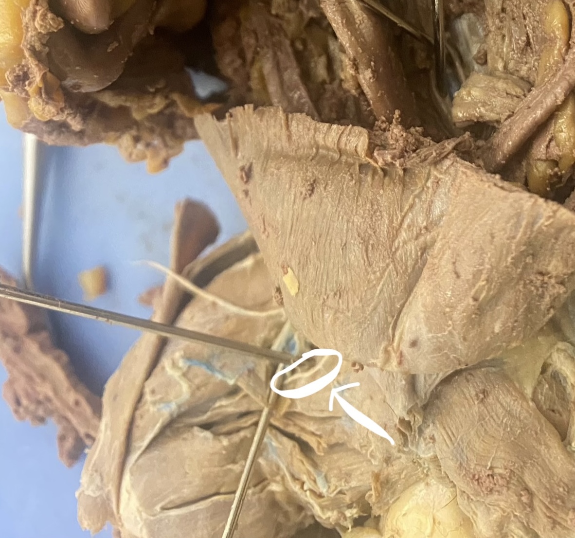 <p>What’s this?</p>
