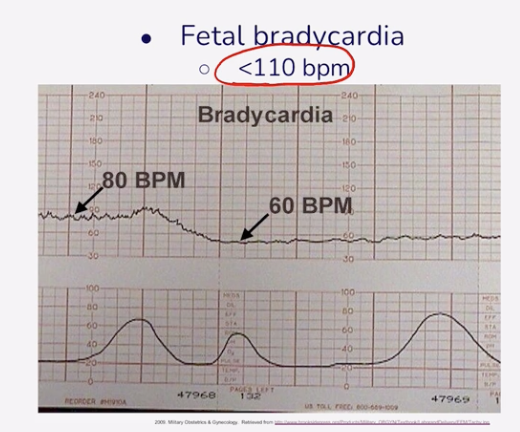 <p>Less than 110 BPM</p>