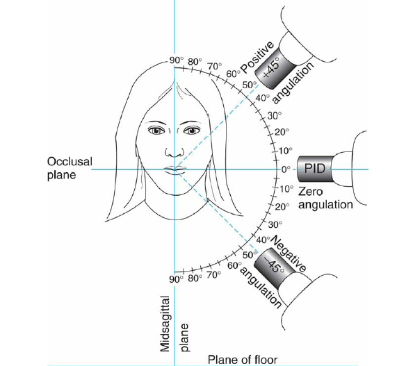 <ul><li><p>bitewing exposures</p></li><li><p>periapical exposures of the maxilla</p></li><li><p>periapical exposures of the maxilla</p></li></ul><p></p>