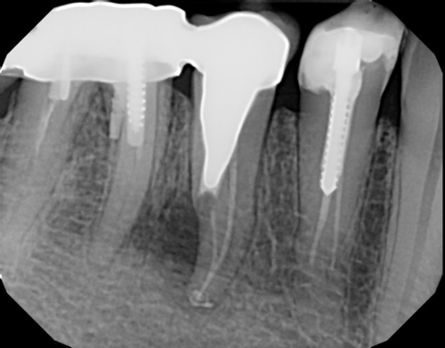 <p>ID the procedural error:</p>