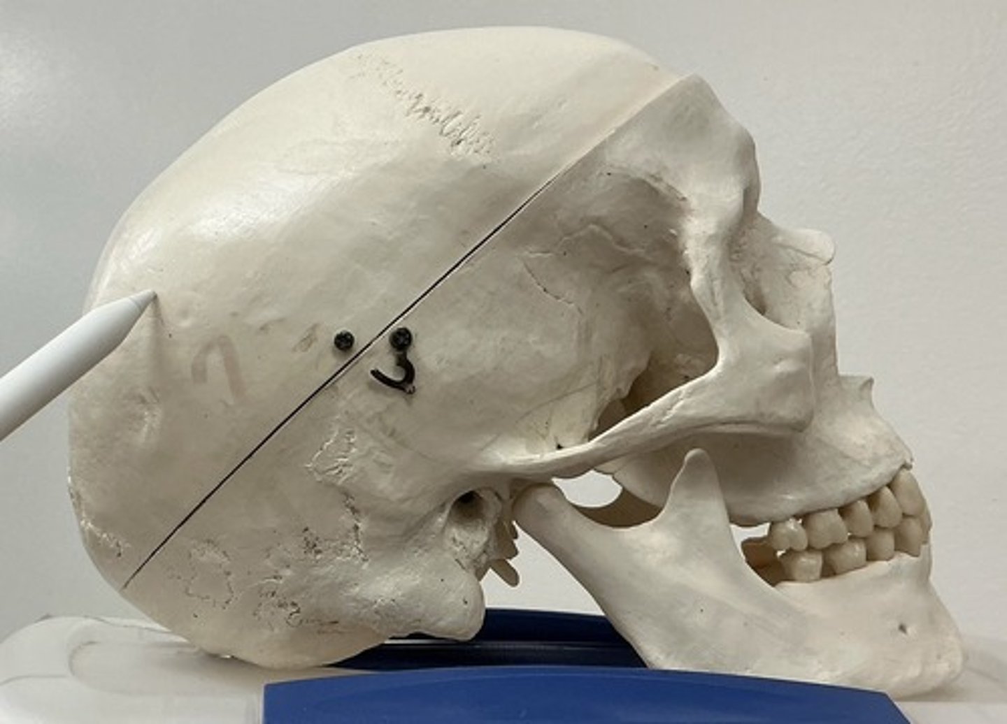 <p>What bone is this?</p>