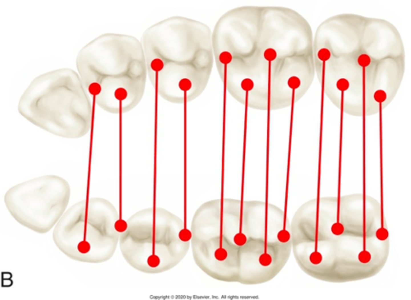 <p>ID the occlusion classification:</p>