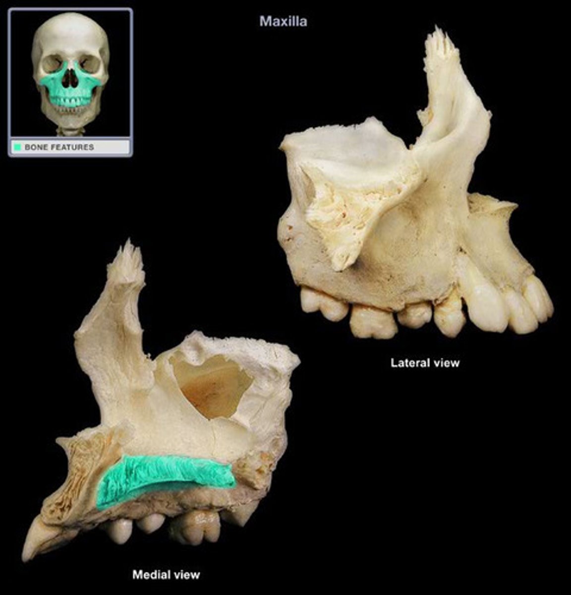 knowt flashcard image