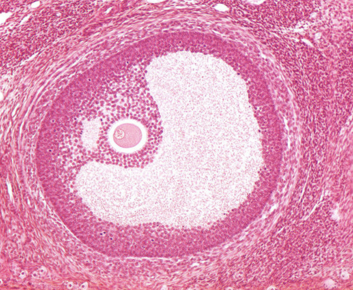 <p>Identify Follicular Stage</p>