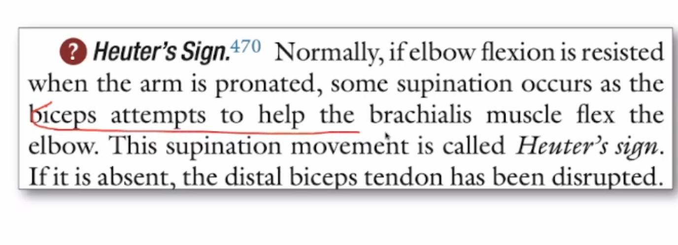 <ul><li><p>B&nbsp;</p></li><li><p>Mnemonic: HIS LOP&nbsp;</p></li></ul><p></p>