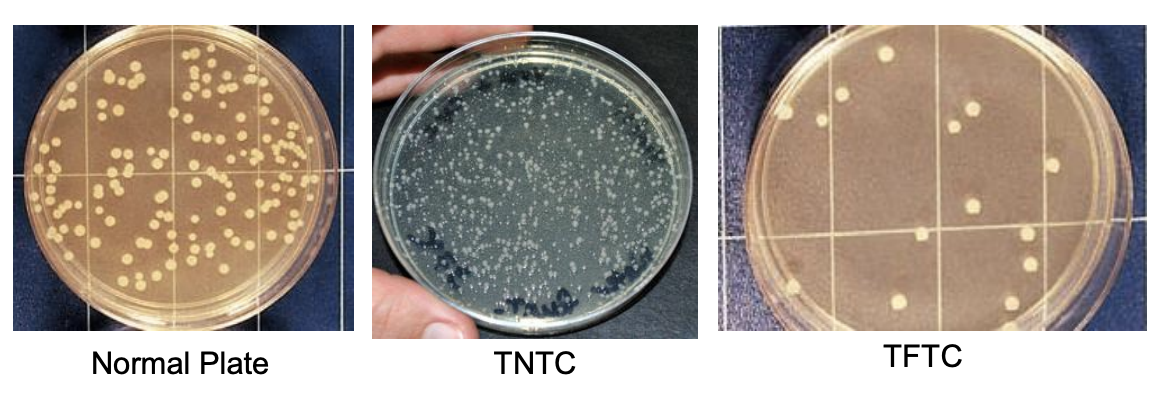 <p>Describe what can is considered a <strong>normal plate</strong></p>