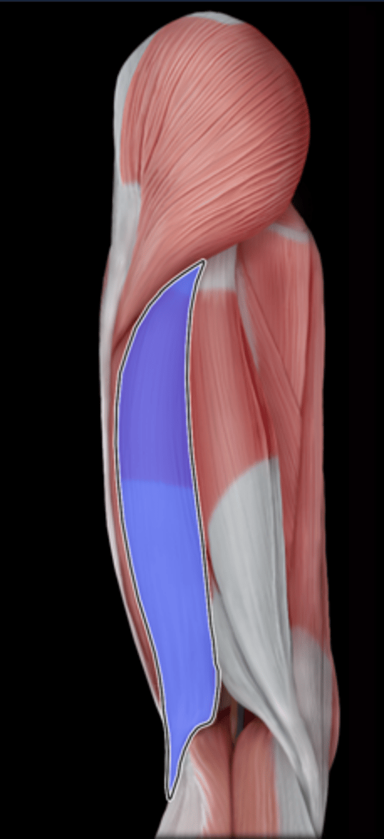 <p>What Muscle Is Highlighted?</p>