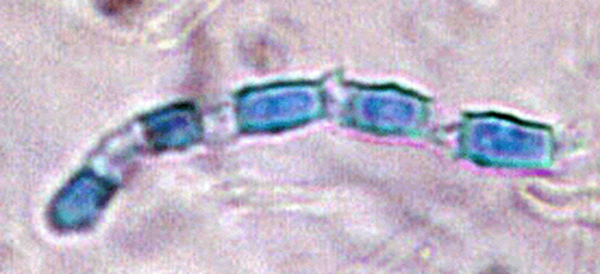 Alternating barrel-shaped arthroconidia

  