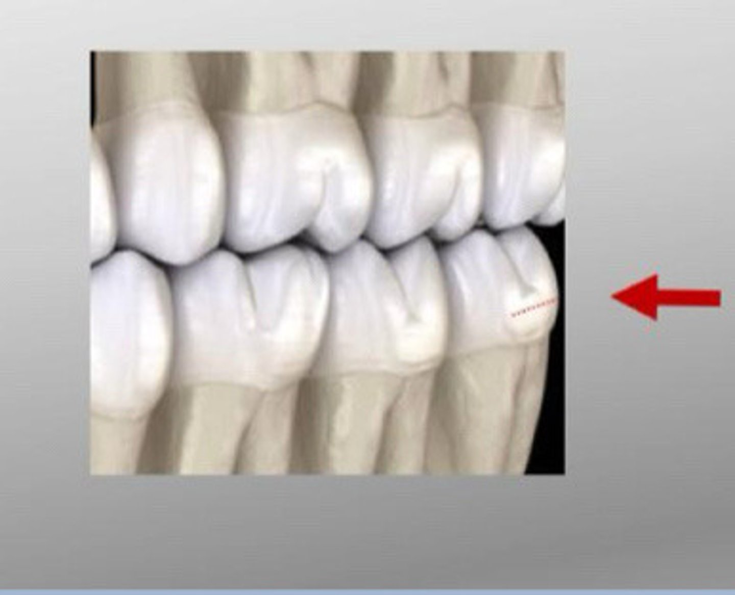 <p>Ridge running mesiodistally (horizontal) in cervical one-third of buccal crown surface on primary dentition and permanent molars</p>