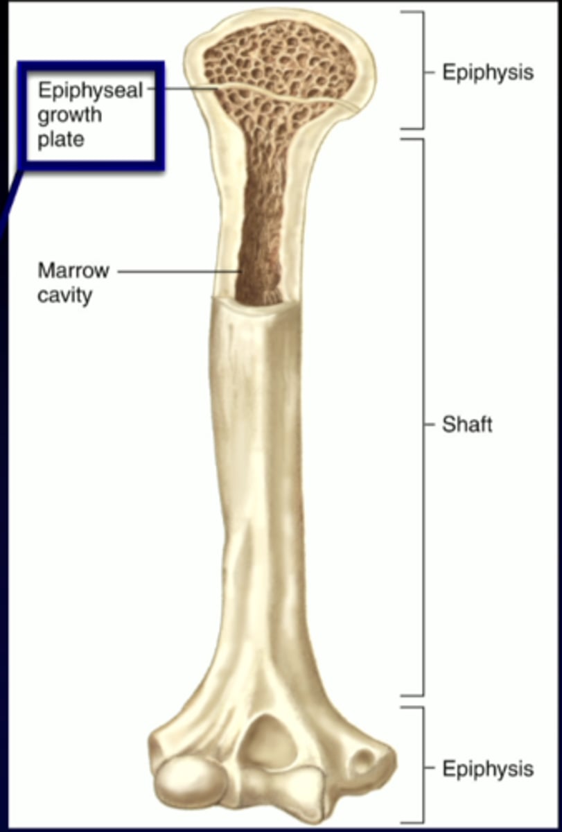 <p>what type of bone is this</p>