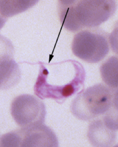 <p><span>This was found on a blood smear from a dog in a kennel in Louisiana where many young dogs are dying. Others are anemic and febrile. What is it?</span></p>