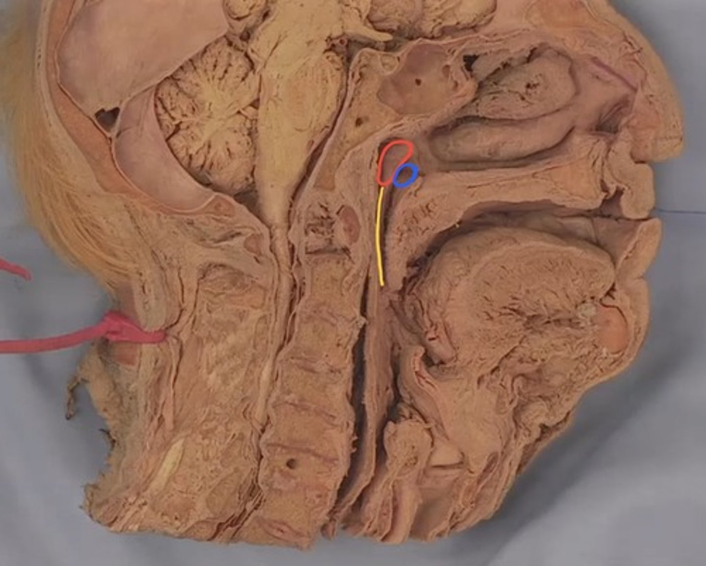 <p>What is the structure outlined in red?</p>