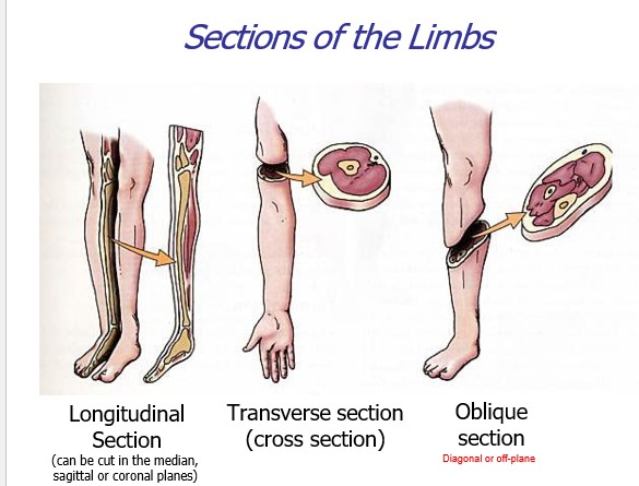 <p>longitudinal section, transverse section, and oblique section</p>