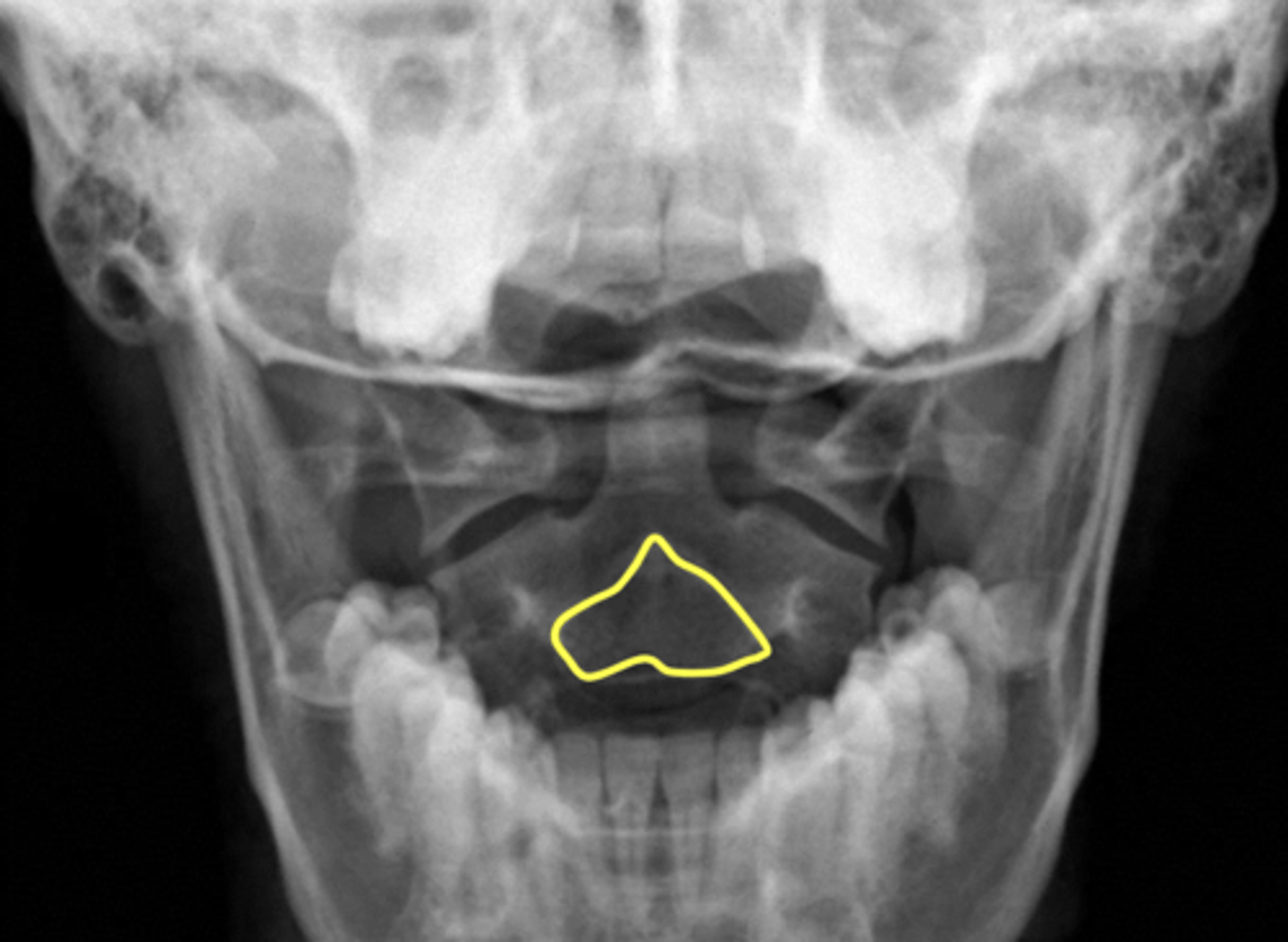 <p>What is outlined in yellow?</p>