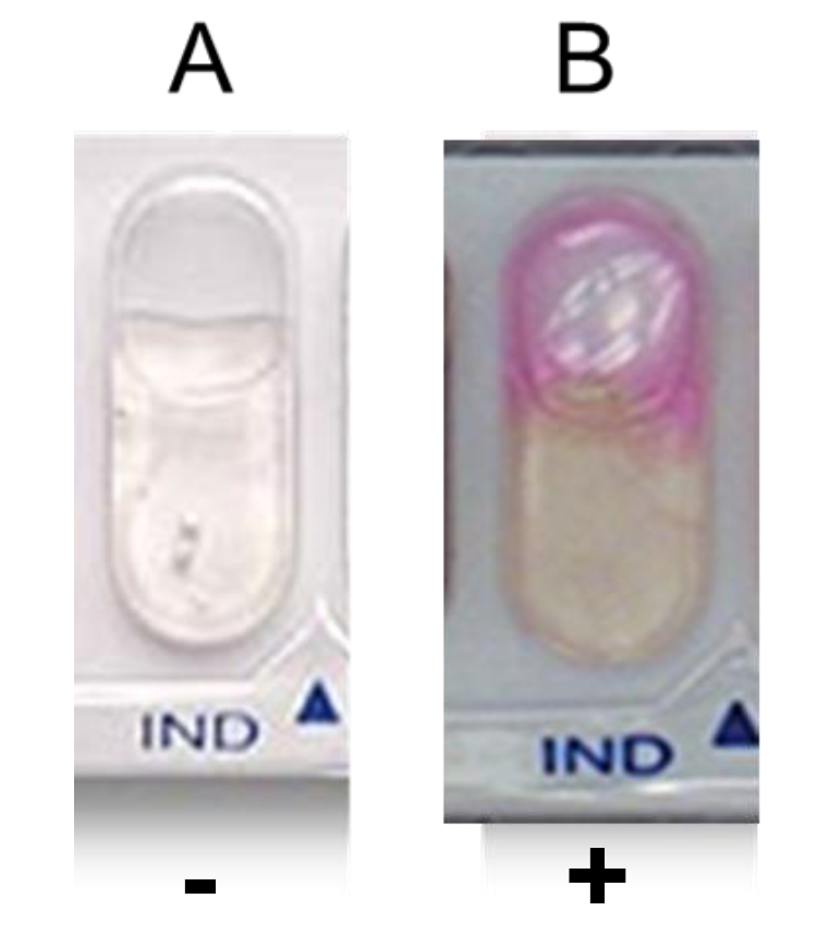 <p><strong>Indole (IND) Test*</strong></p><p>Determine if bacteria can produce indole from tryptophan by tryptophanase</p><p><em>Post-incubation - add Kovac’s reagent to determine if bacteria can produce indole</em></p><ul><li><p>Positive test: pink ring in cupule</p></li><li><p>Negative: no color change</p></li></ul><p></p>