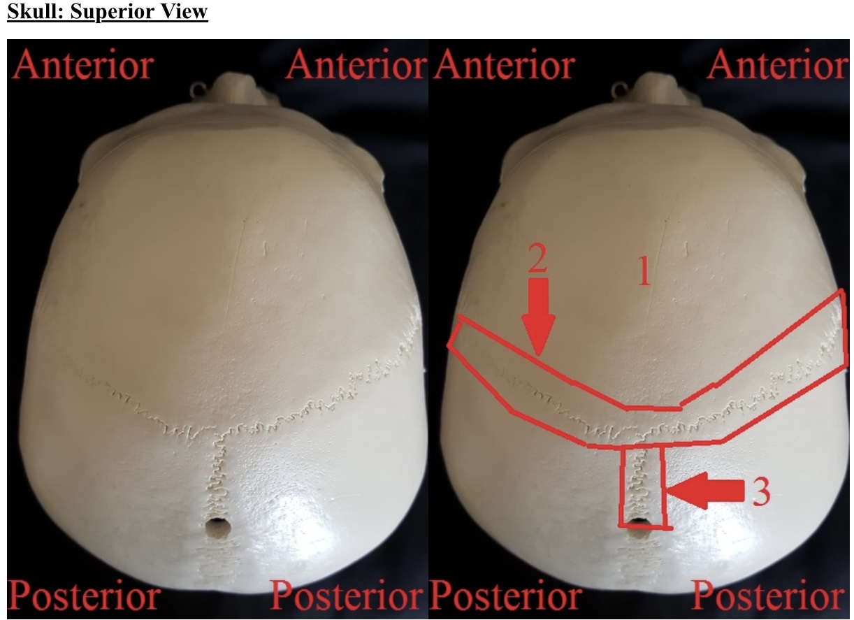 <p>1) name this bone</p>