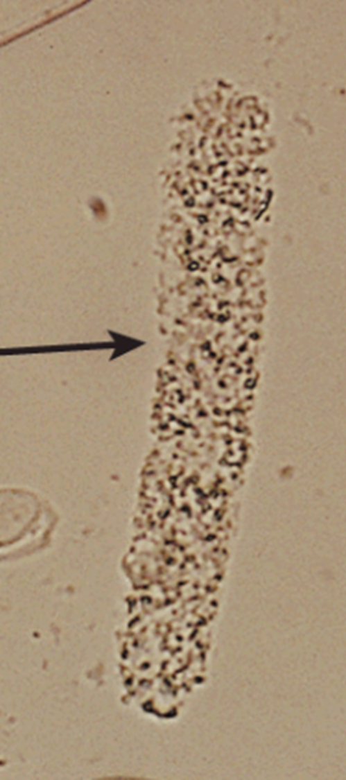 <p>HPF</p>