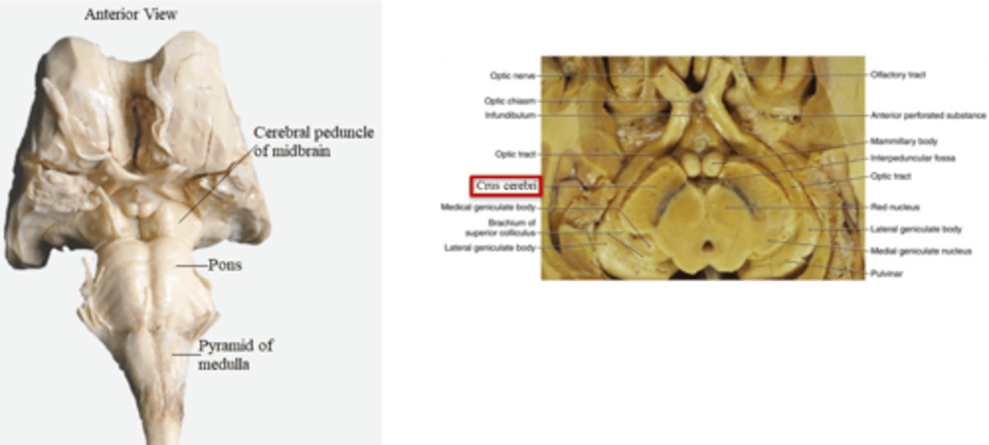 <p>midbrain; crus cerebri</p>