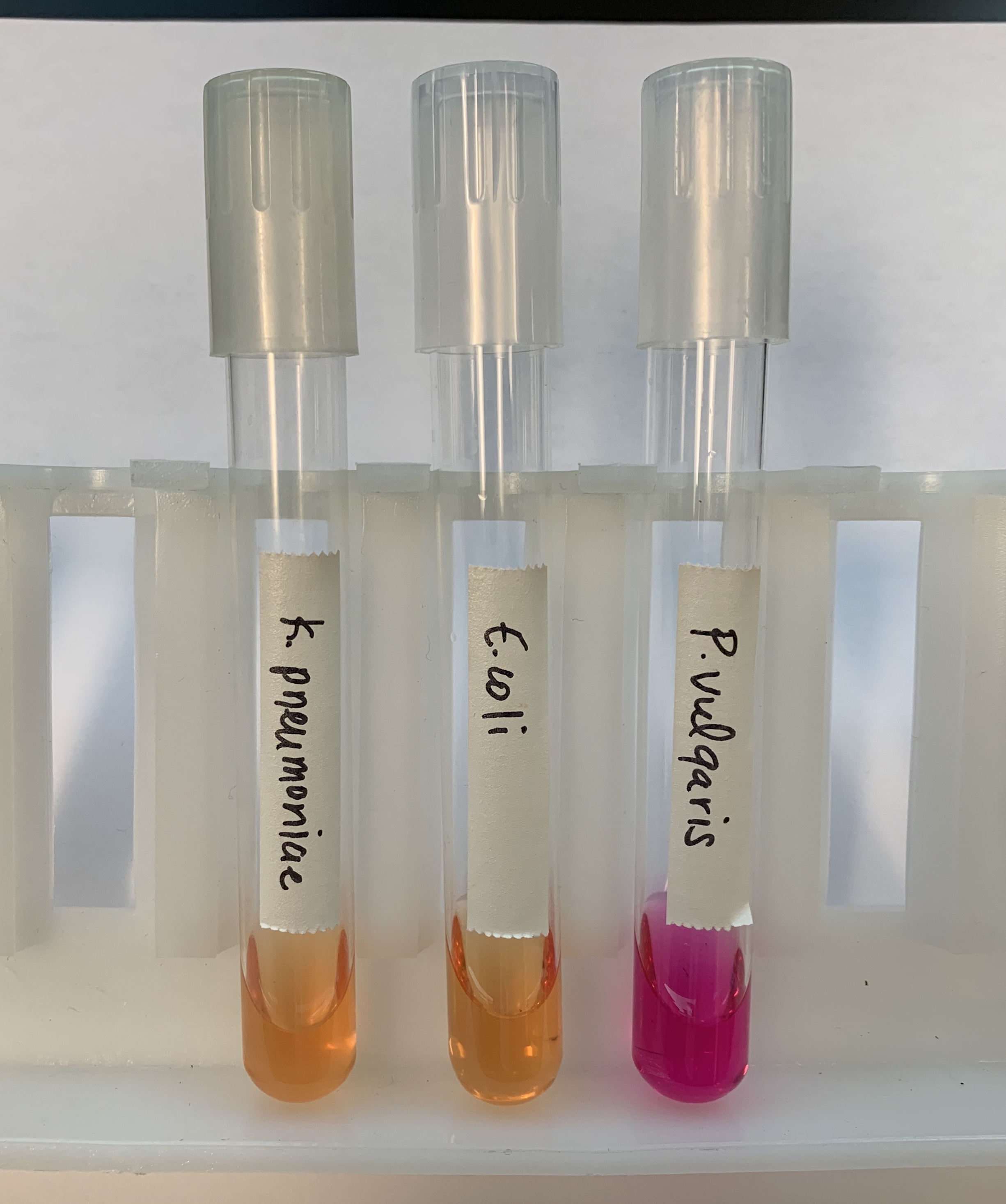 <p>#18 Hydrolysis of Urea </p>