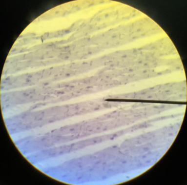 <p>What is this type of muscle?</p>