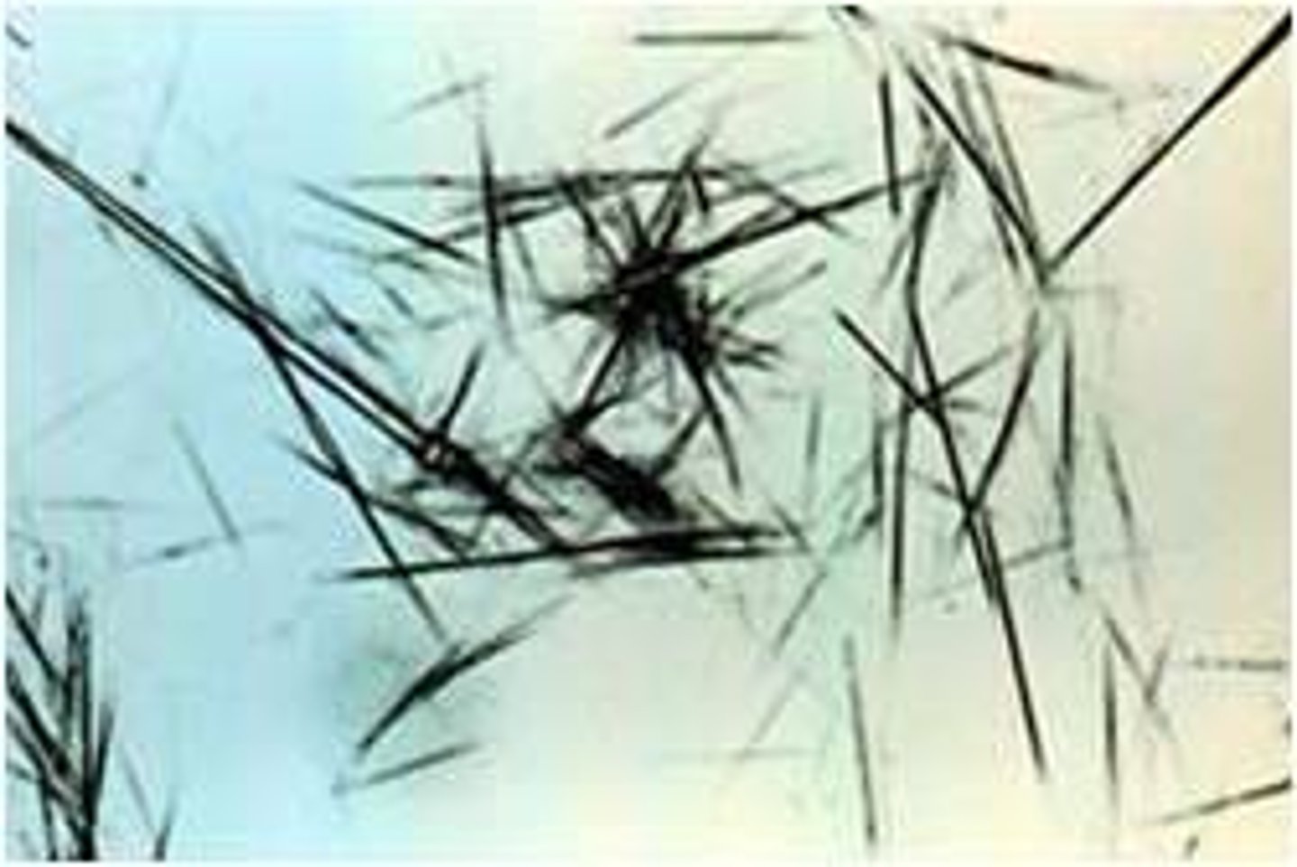 <p>abnormal, bundles following refrigeration, infection treatment</p>