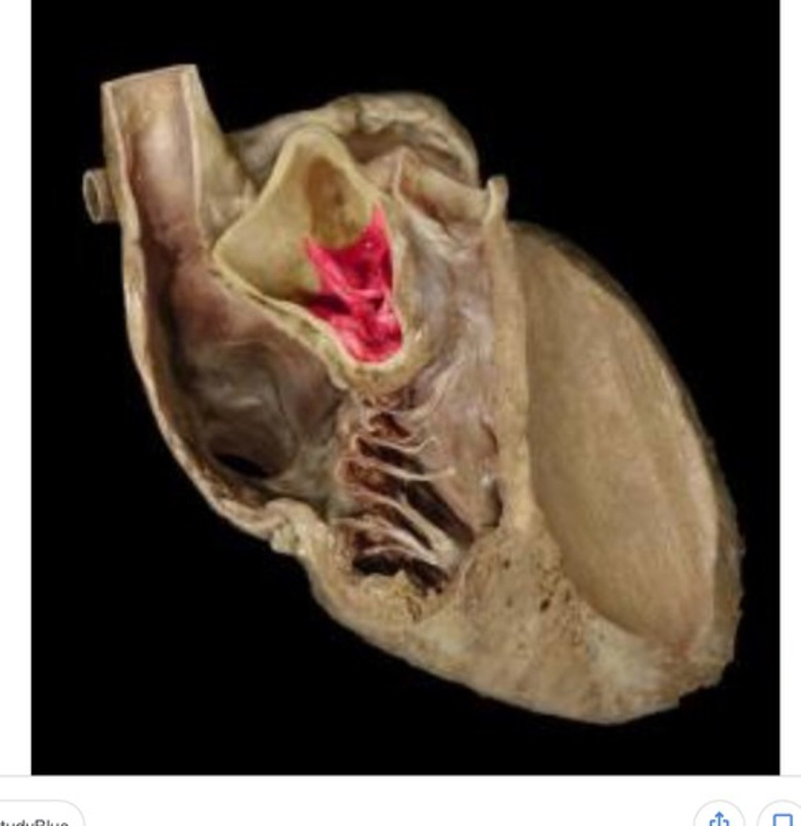 <p>(END of S2) 3 components. The ones shown inside.</p>