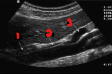 <p>Label the structures seen in this image. </p>