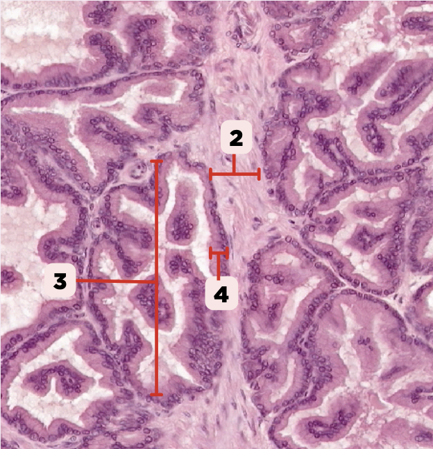 <p>Identify the structure labeled as 2.</p>