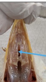 <p>passage between oral and nasal; cavities</p>