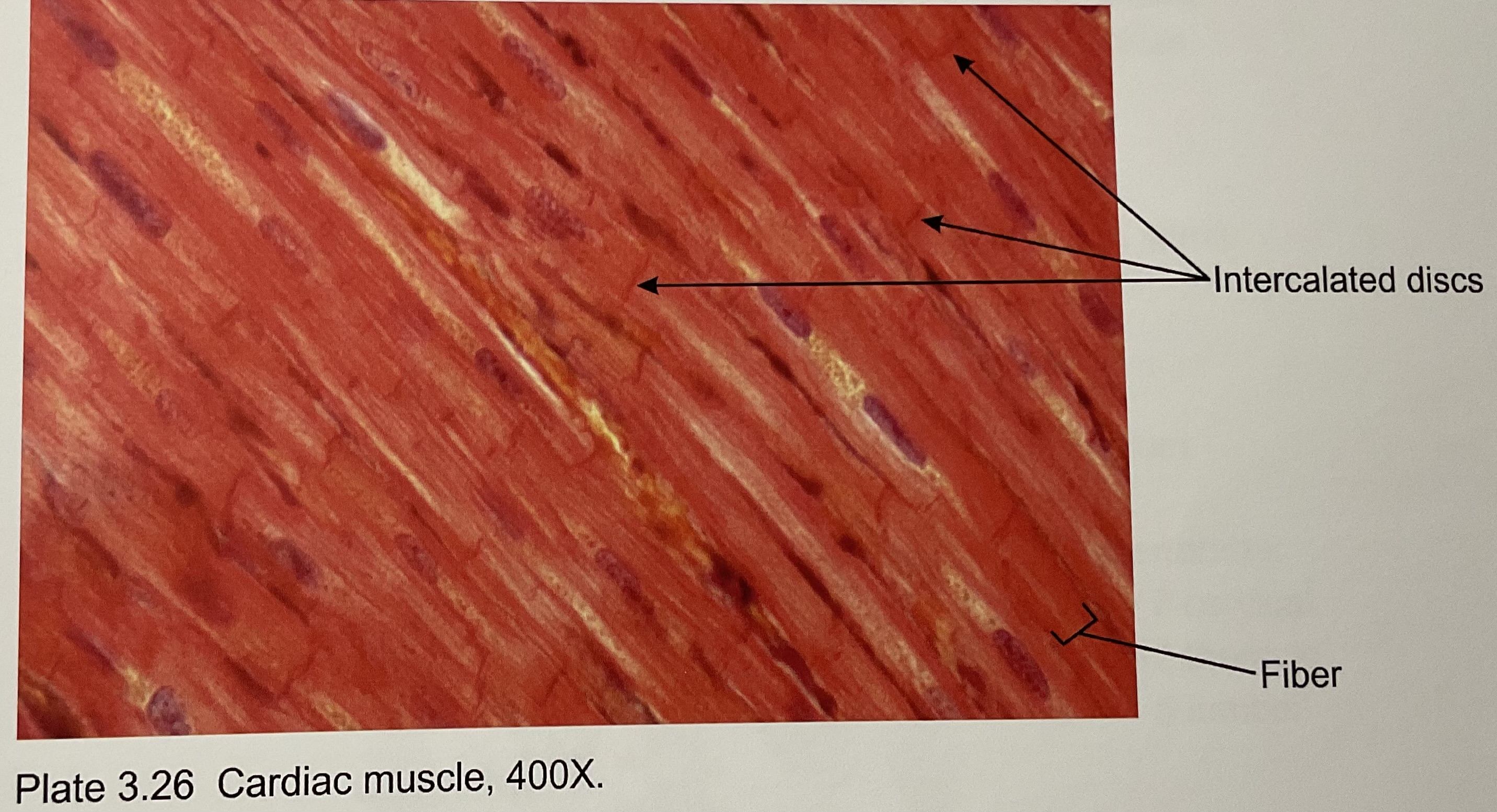 <p>Cardiac</p>