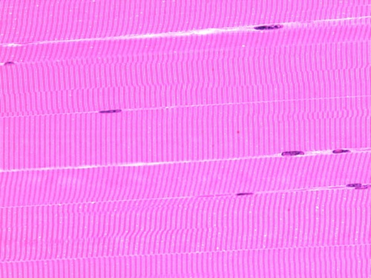 <p>what component of muscle tissue are the lines</p>